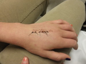 Left Hand, no bandage